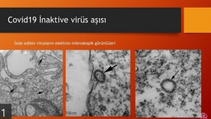 İlk koronavirüs aşı çalışmasını yapan Ercüment Ovalı bakanlığa raporunu sundu