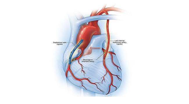 Son zamanlarda stres arttı - Kalbinizdeki ağrıları dikkate alın! Kardiyoloji Kalp ve Damar Cerrahisi Doç. Dr. Cenal!