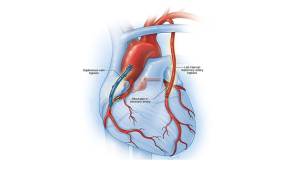 Son zamanlarda stres arttı - Kalbinizdeki ağrıları dikkate alın! Kardiyoloji Kalp ve Damar Cerrahisi Doç. Dr. Cenal!