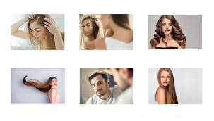 Saç dökülmesi nedir - Saç dökülmesinin nedenleri? Acıbadem Hastanesi Prof. Dr. Durmaz!