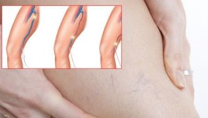 Varis, kalp kapakçıklarımız ile ilgili bizi uyarıyor! Kalp Ve Damar Cerrahisi Prof. Dr. Ali Rıza Cenal 