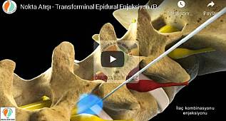 Bel - boyun fıtığı nedir? Nasıl tedavi edilir? Beyin Cerrahi Dr. Deniz...